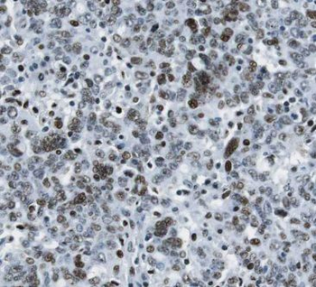 CCNH1 Rabbit Polyclonal Antibody
