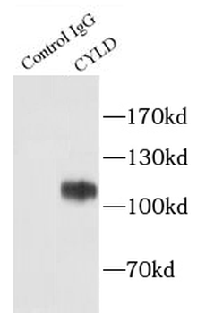 CYLD Antibody