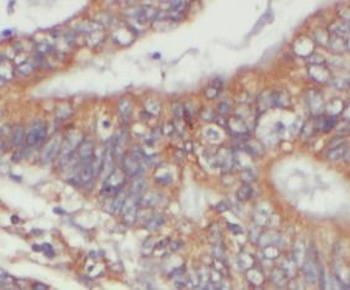 CYLD Antibody
