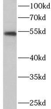 CYP19A1 Rabbit Polyclonal Antibody