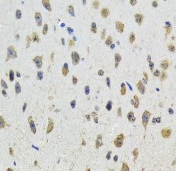 CYP19A1 Rabbit Polyclonal Antibody