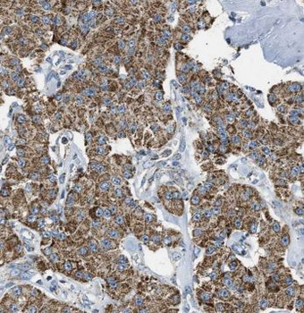 CYP1B1 Antibody