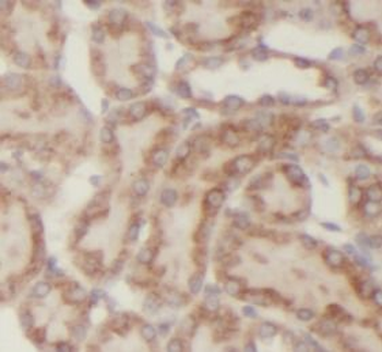 CYP24A1 Antibody