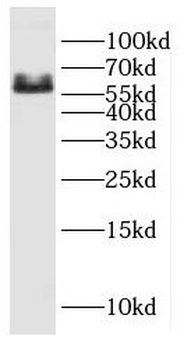 CYP26B1 Antibody
