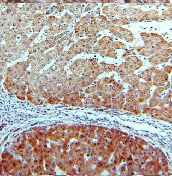 CYP26B1 Antibody