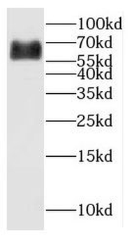 CYP27A1 Antibody