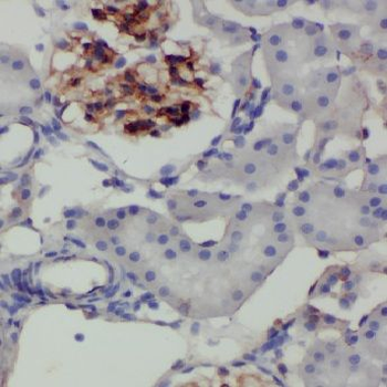 CYP27A1 Antibody