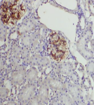 CYP27A1 Antibody