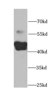 CYP2F1 Rabbit Polyclonal Antibody