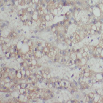 CYP2J2 Antibody