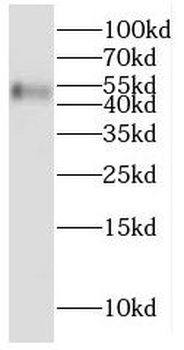CYP2W1 Antibody