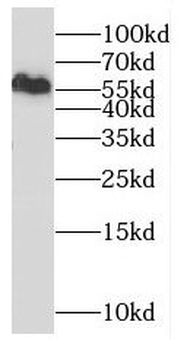CYP3A5 Rabbit Polyclonal Antibody