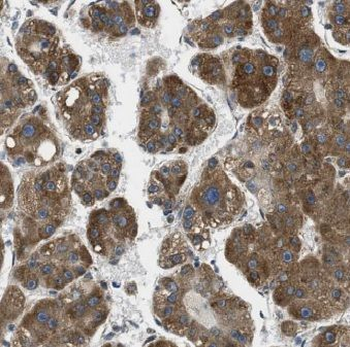 CYP3A5 Rabbit Polyclonal Antibody