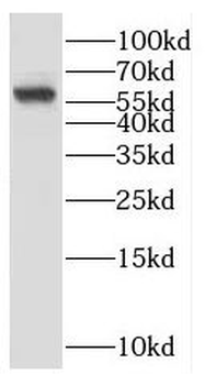CYP4A11 Antibody