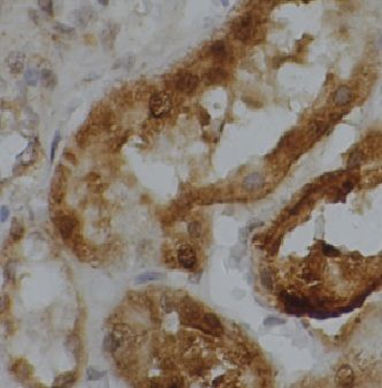 CYP4A11 Antibody