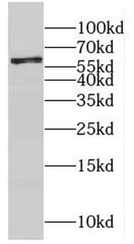 CYP4F12 Rabbit Polyclonal Antibody