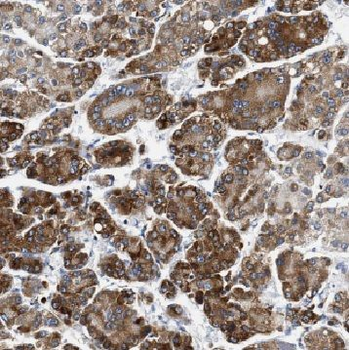 CYP7B1 Antibody