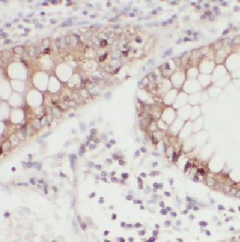CSTB Antibody
