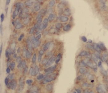 CST7 Antibody