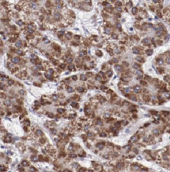 CYB5R3 Antibody
