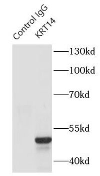KRT14 Rabbit Polyclonal Antibody