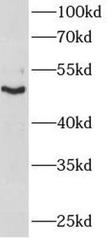 KRT14 Mouse Monoclonal Antibody