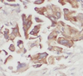 KRT14 Mouse Monoclonal Antibody