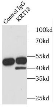 KRT18 Rabbit Polyclonal Antibody