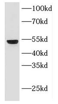KRT18 Rabbit Polyclonal Antibody