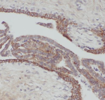 KRT18 Rabbit Polyclonal Antibody