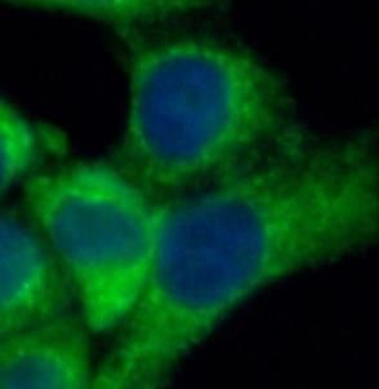 KRT18 Rabbit Polyclonal Antibody