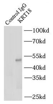 KRT18 Rabbit Polyclonal Antibody