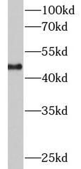 KRT18 Rabbit Polyclonal Antibody