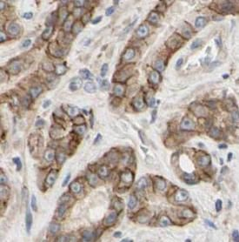 KRT18 Rabbit Polyclonal Antibody