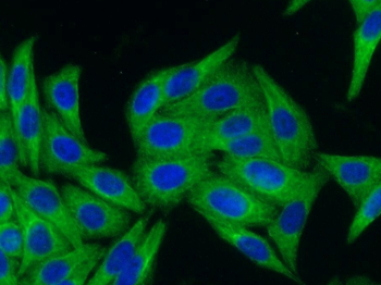 KRT18 Mouse Monoclonal Antibody