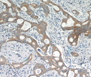 KRT18 Mouse Monoclonal Antibody