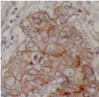 KRT19 Mouse Monoclonal Antibody