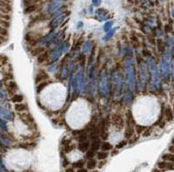 KRT20 Antibody
