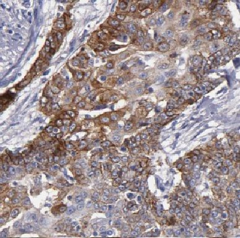 KRT4 Antibody