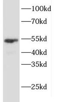 KRT7 Rabbit Polyclonal Antibody
