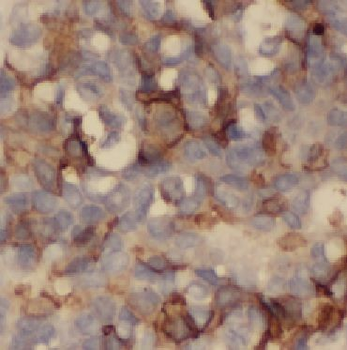 KRT7 Rabbit Polyclonal Antibody