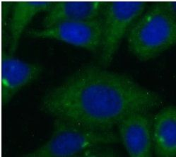 KRT8 Rabbit Polyclonal Antibody
