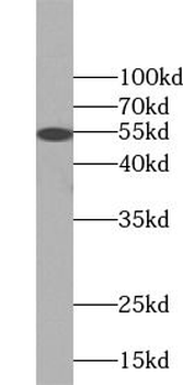 KRT8 Rabbit Polyclonal Antibody
