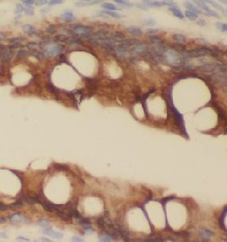 KRT8 Rabbit Polyclonal Antibody