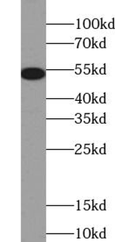 KRT8 Mouse Monoclonal Antibody