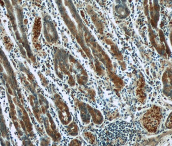 KRT8 Mouse Monoclonal Antibody