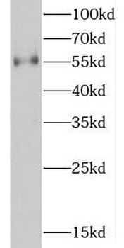 D2HGDH Antibody