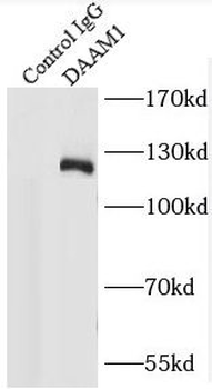 DAAM1 Antibody