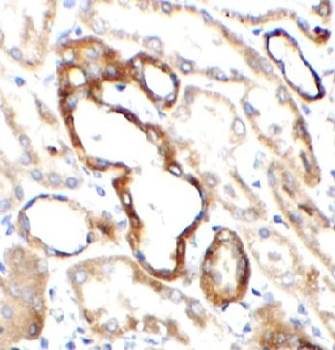 DAB2 Antibody