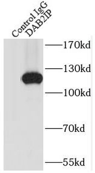 DAB2IP Antibody